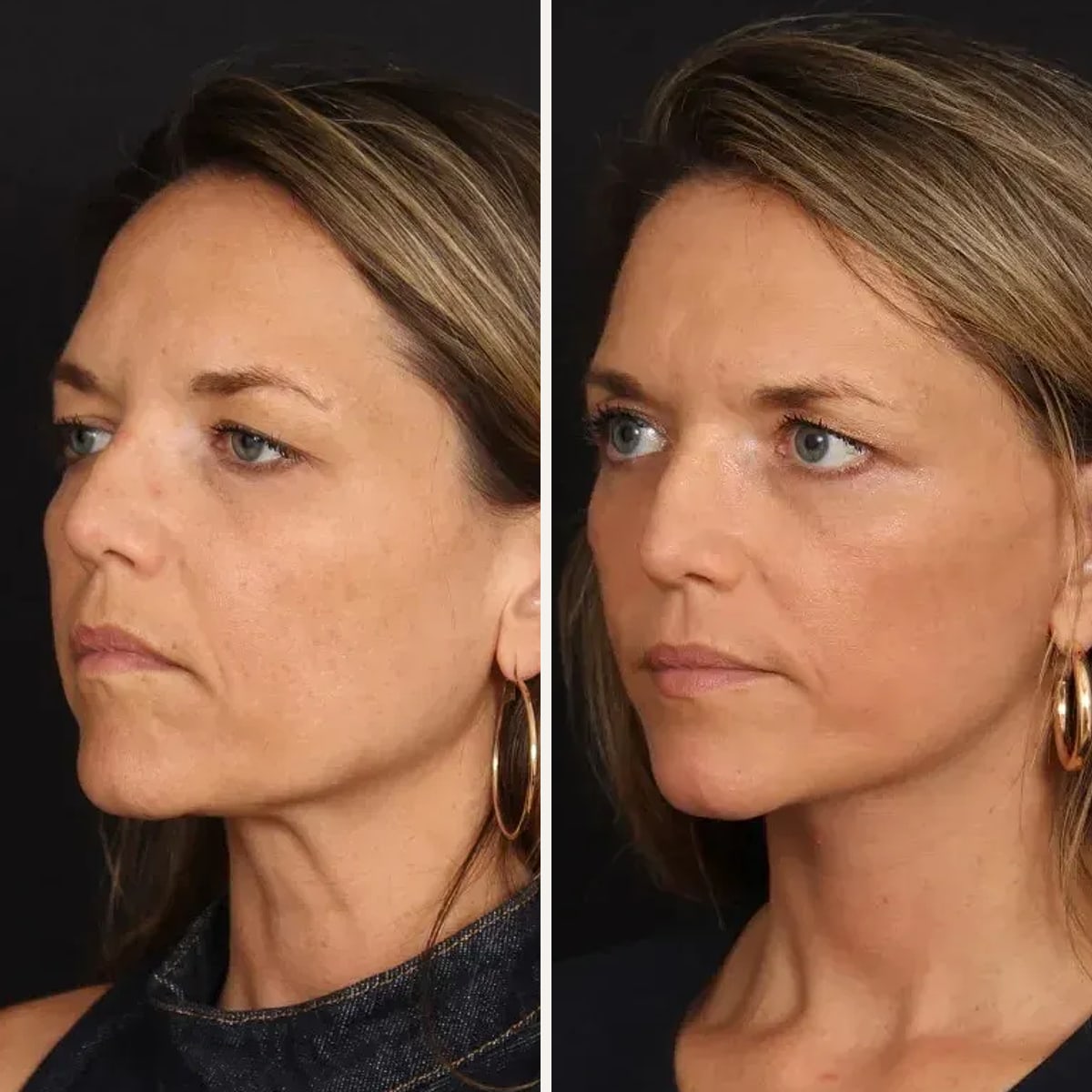 Before and after: Dr. Patrick Davis