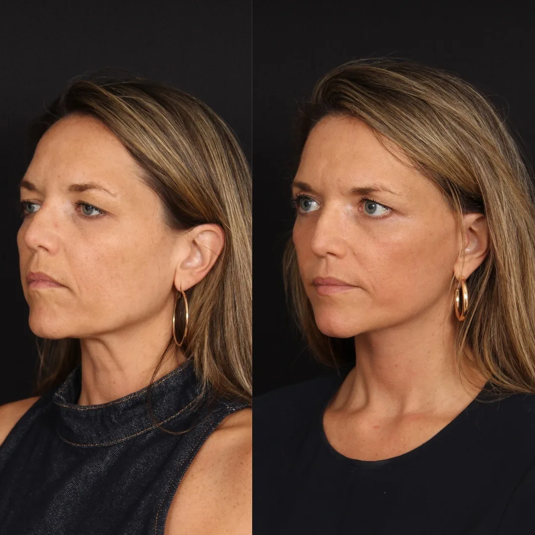 Before and after — Dr. Patrick Davis