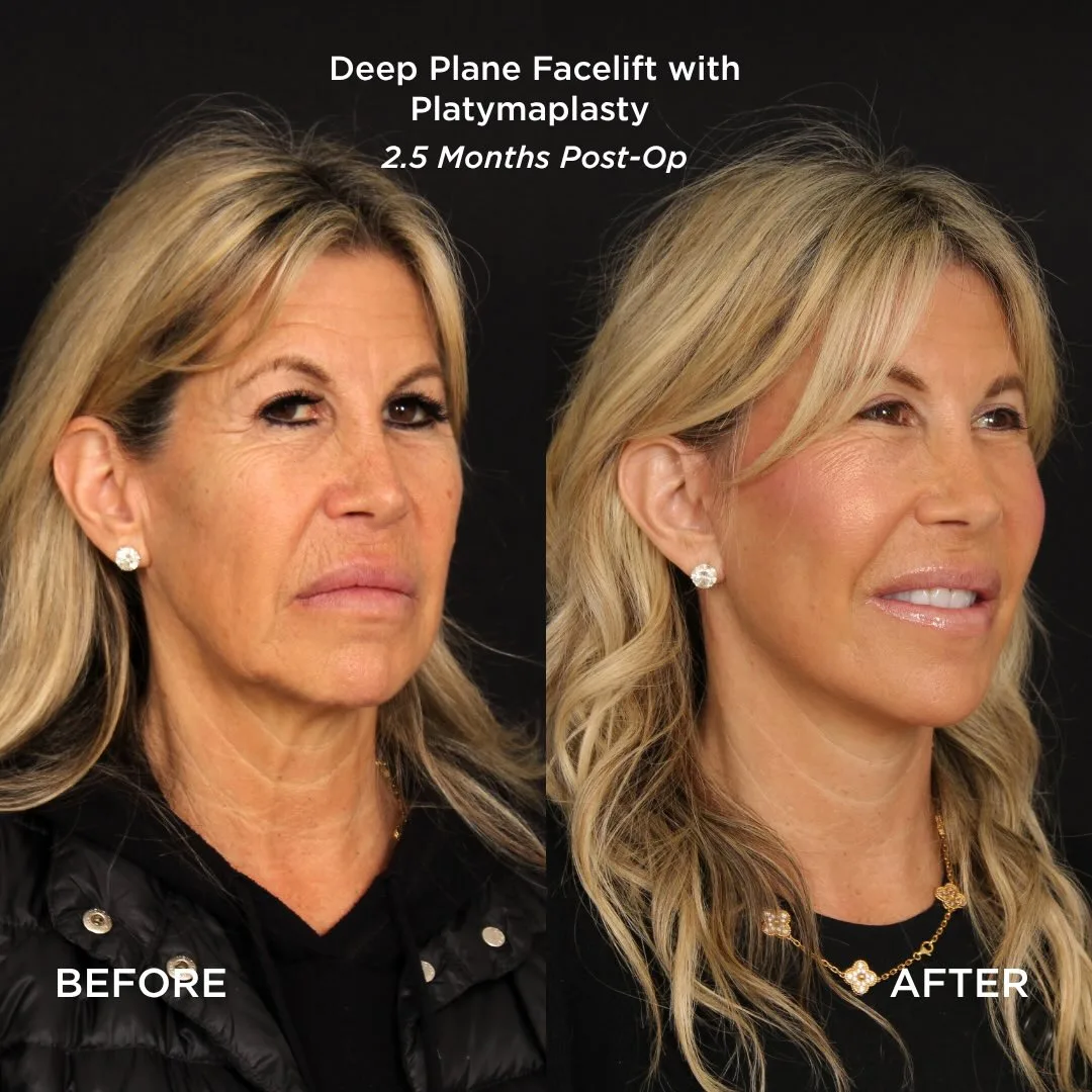 Before and after — Dr. Patrick Davis