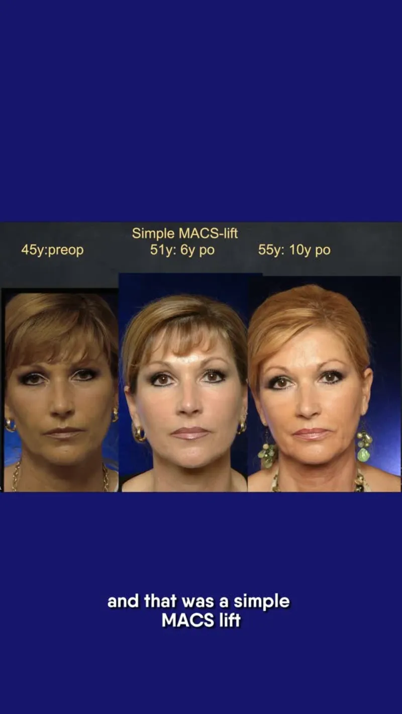 Before and after: Dr. Patrick Tonnard