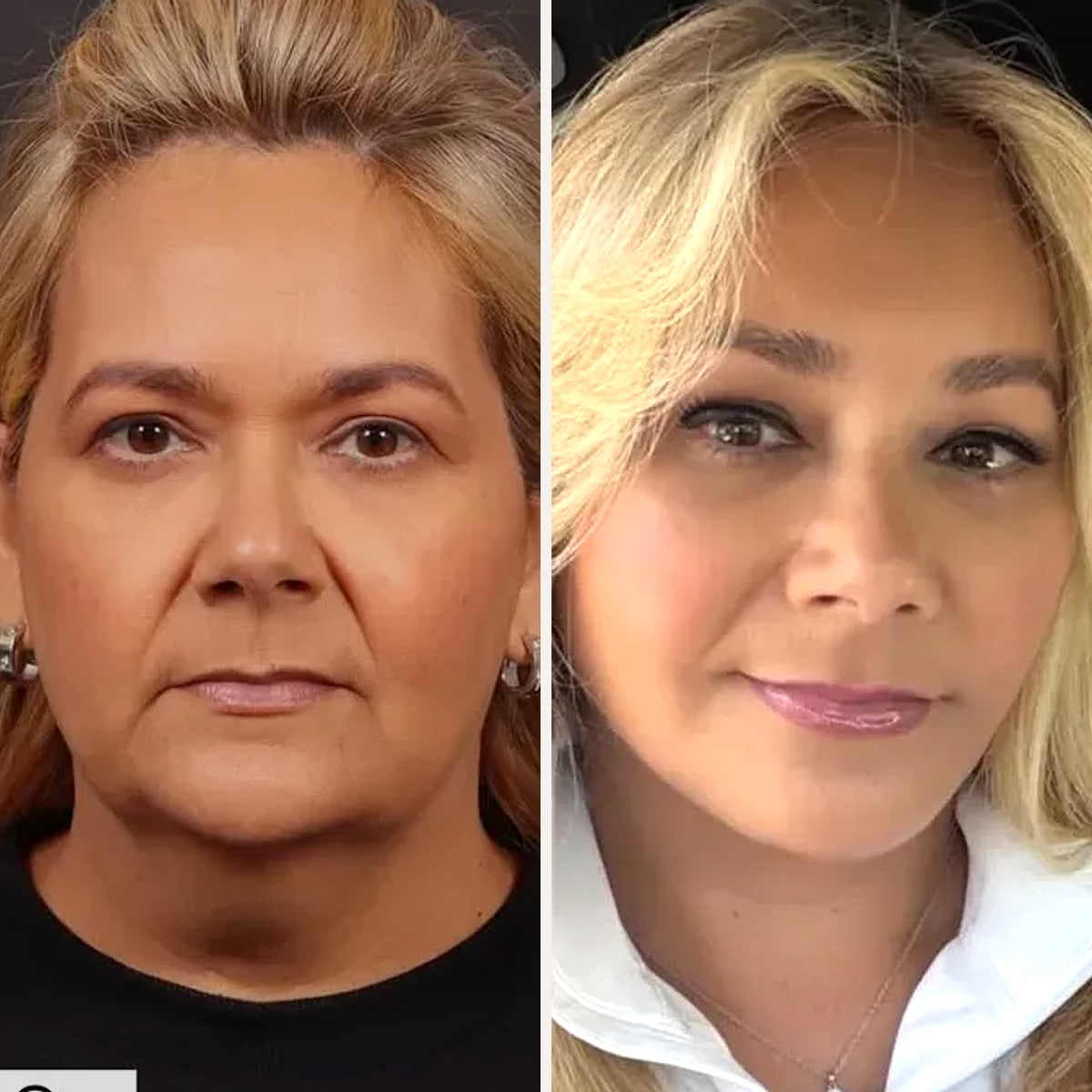 Before and after: Dr. Paul Afrooz