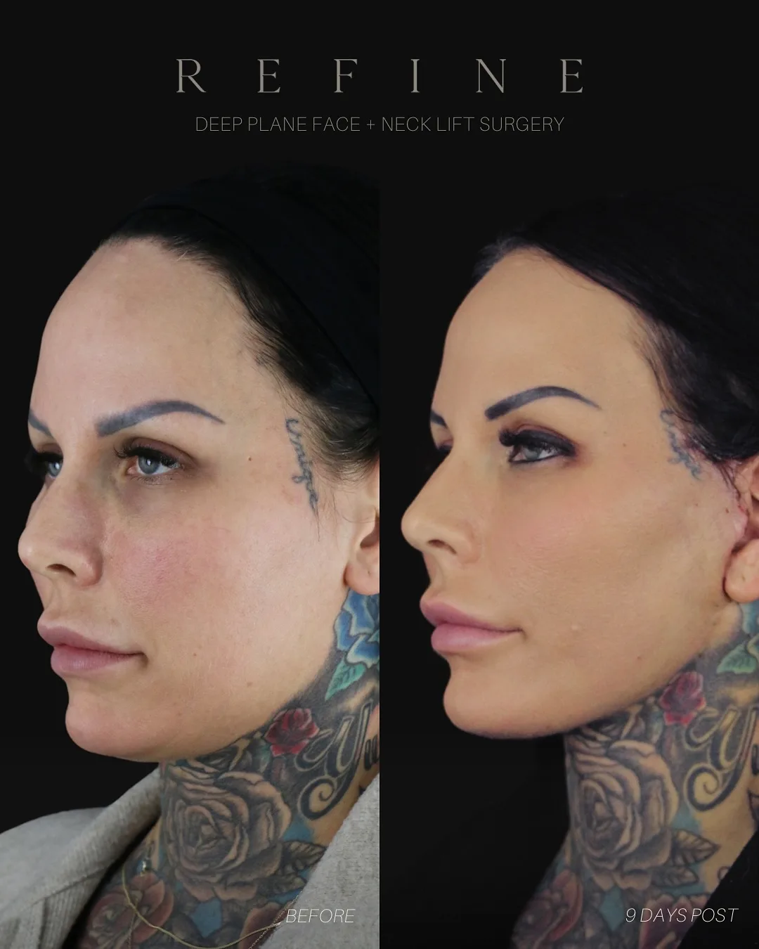 Before and after — Dr. Paul Denton