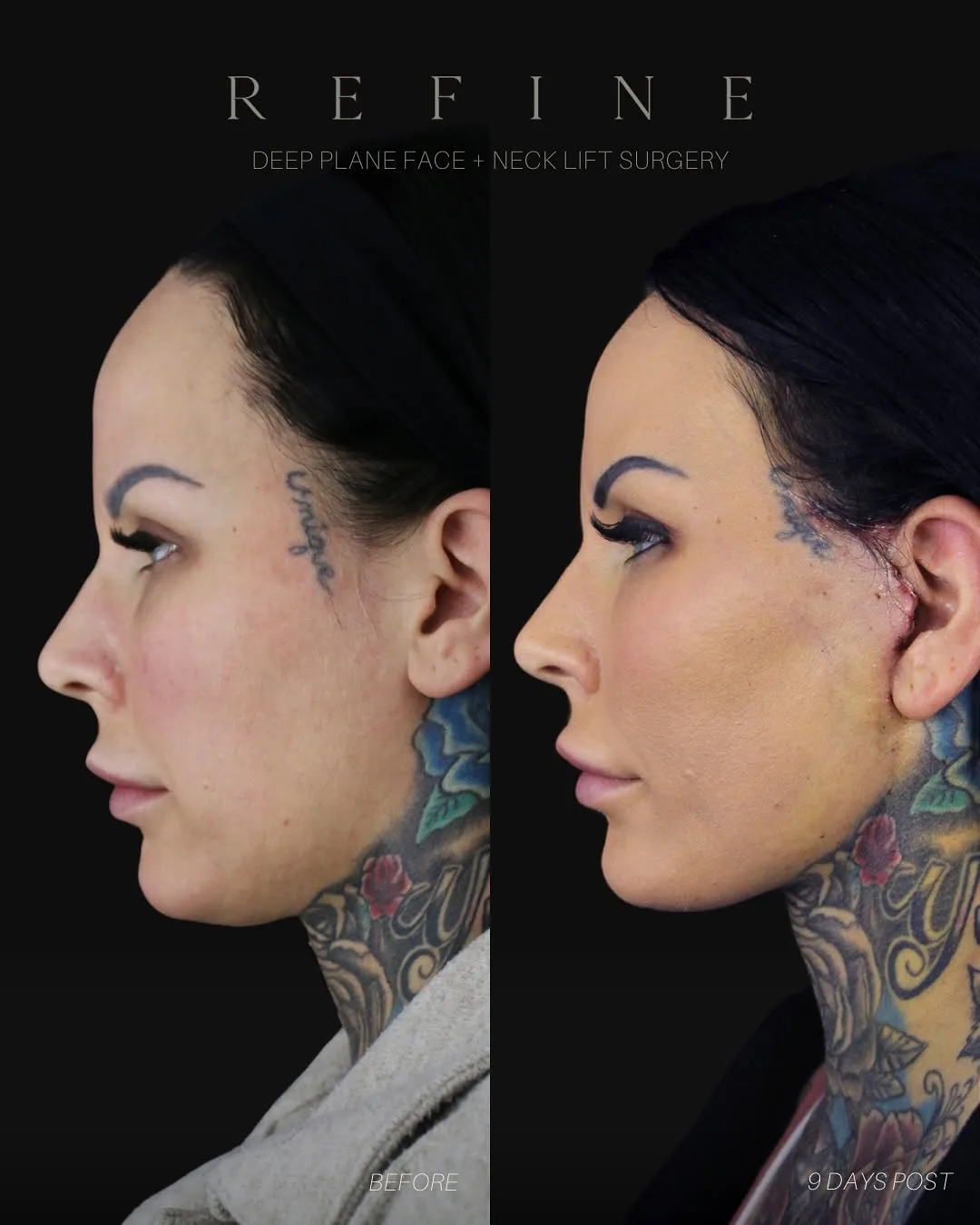 Before and after — Dr. Paul Denton