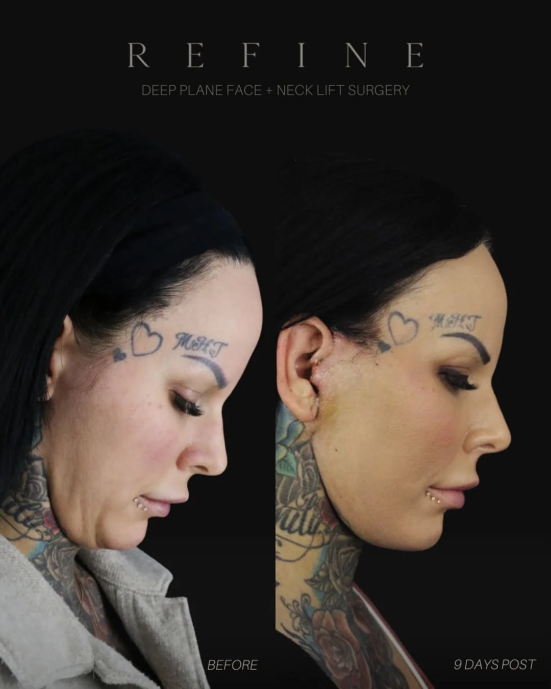 Before and after — Dr. Paul Denton