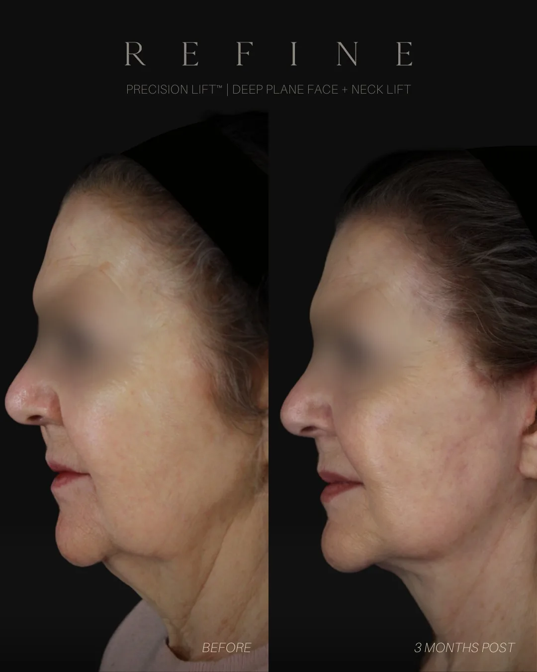 Before and after — Dr. Paul Denton