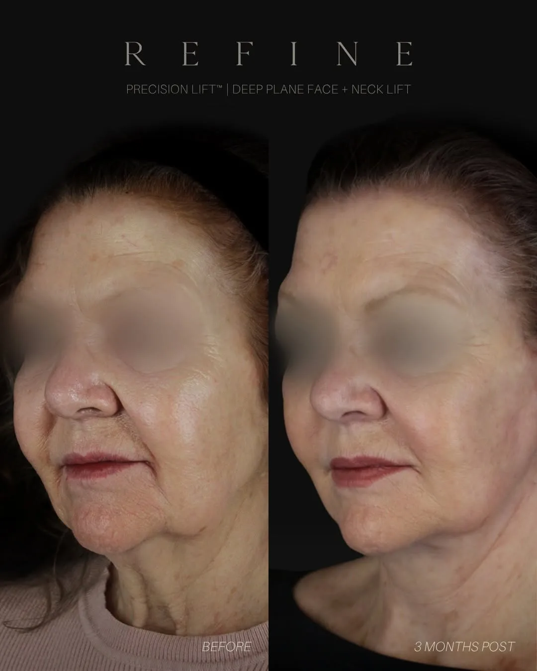 Before and after — Dr. Paul Denton