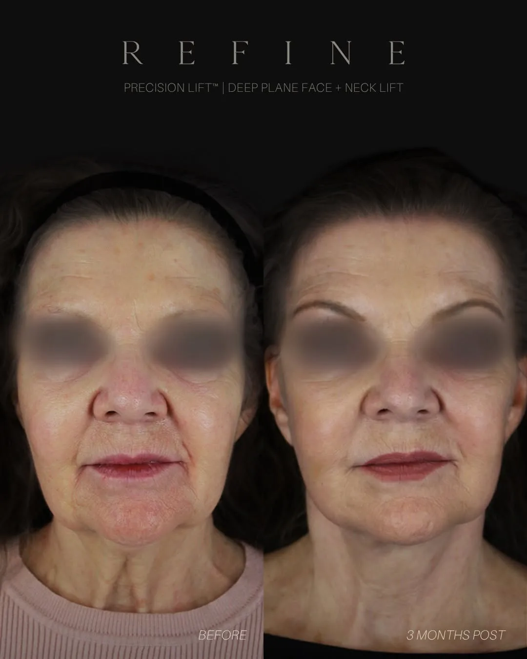 Before and after — Dr. Paul Denton