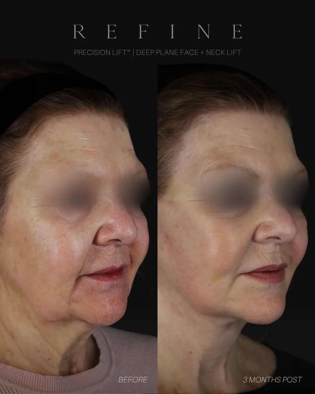 Before and after — Dr. Paul Denton