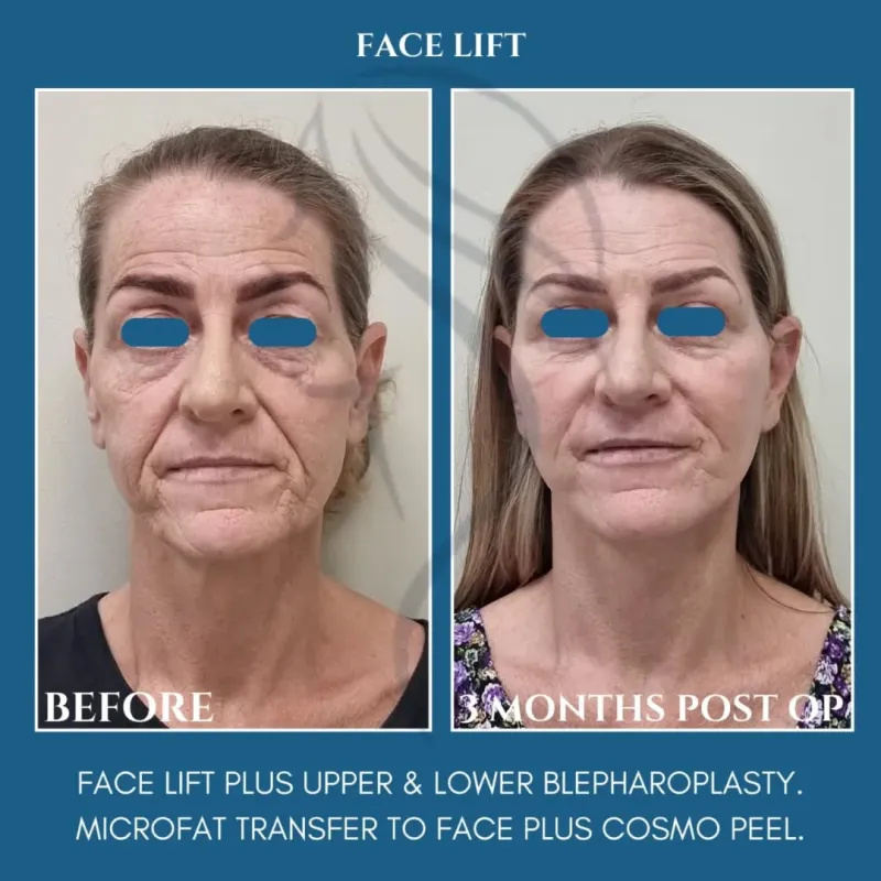 Before and after: Dr. Paul McGarr