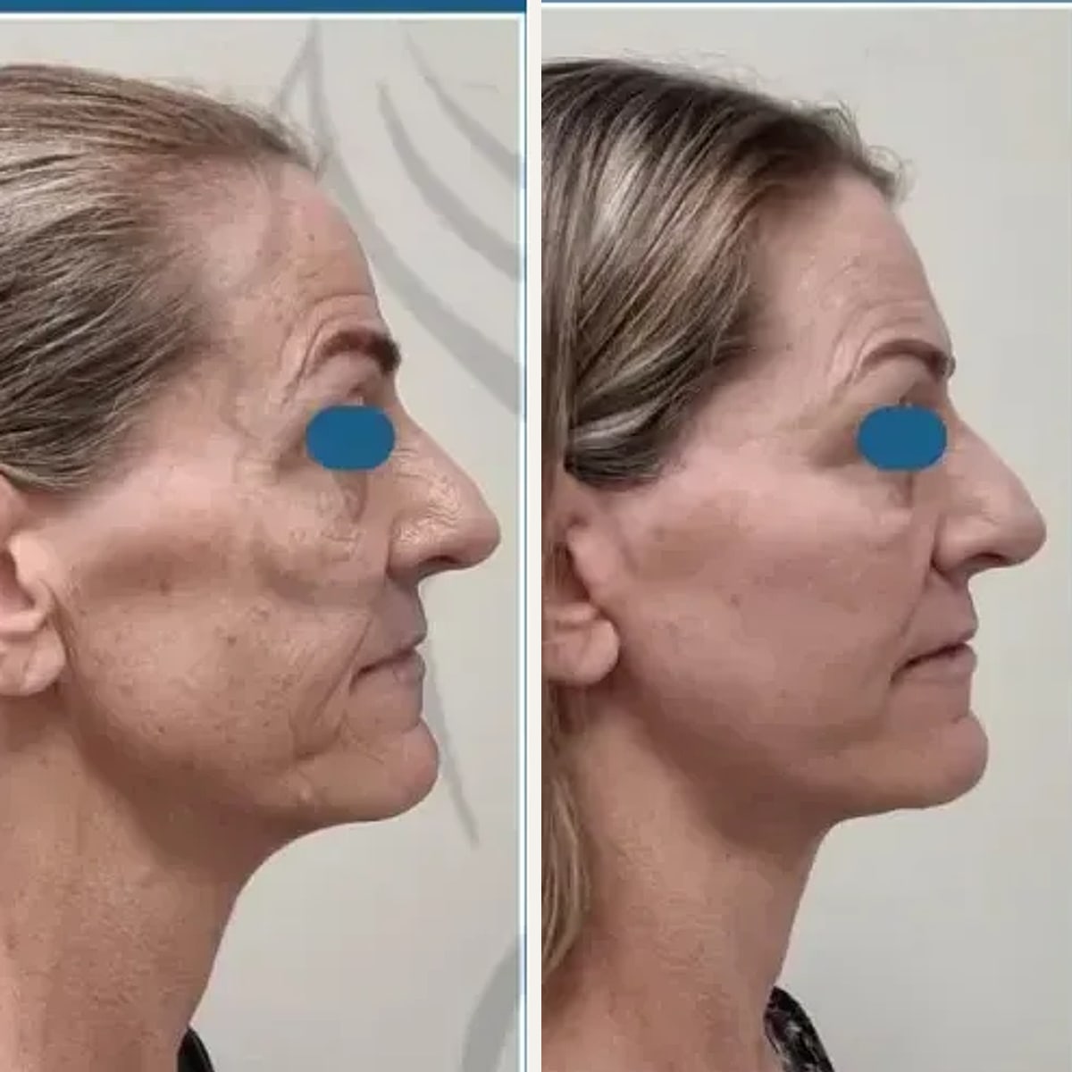 Before and after: Dr. Paul McGarr