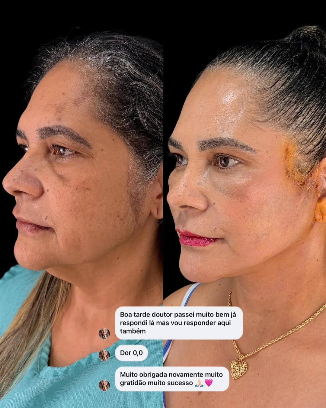 Before and after — Dr. Paulo Almeida