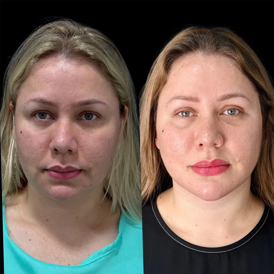 Before and after — Dr. Paulo Almeida