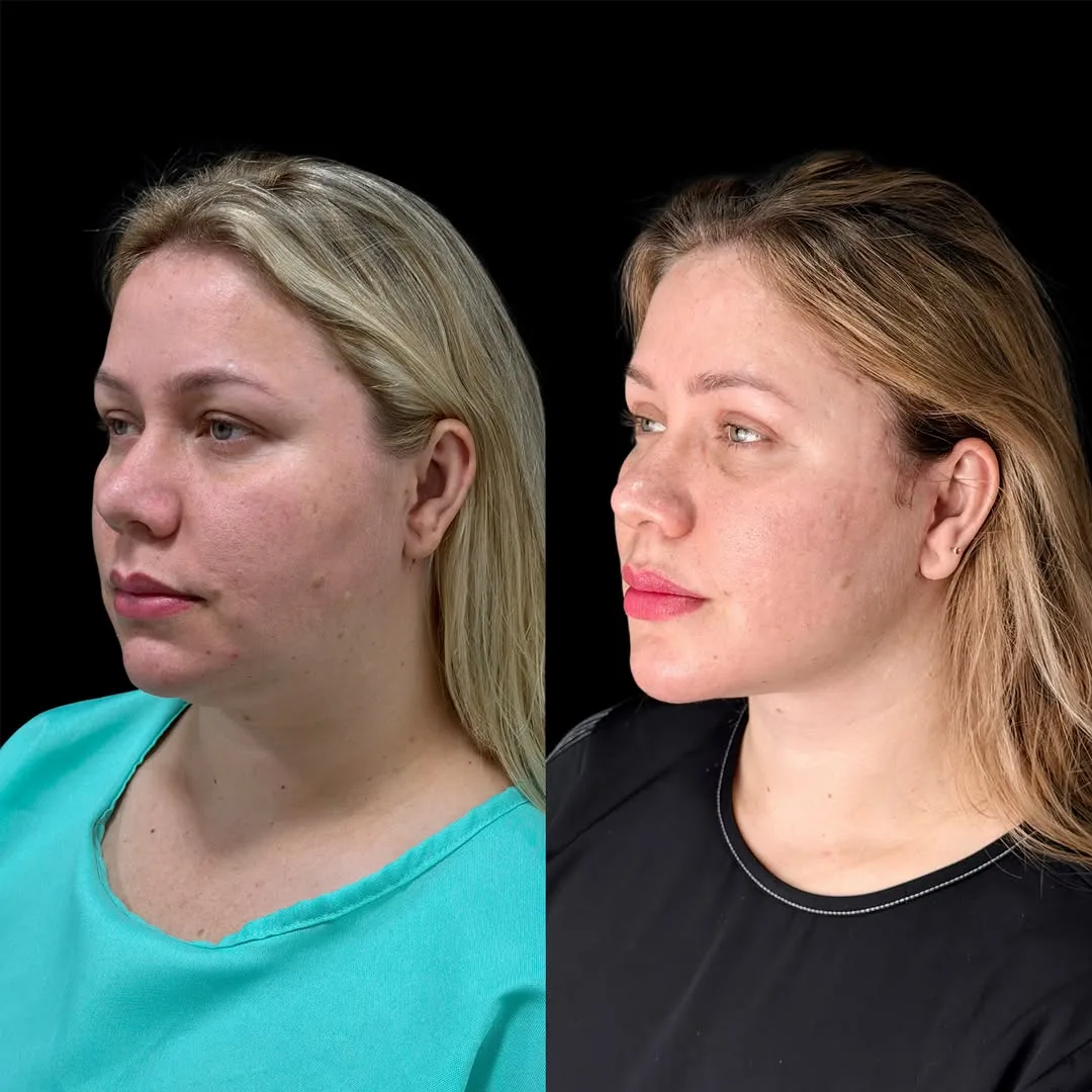 Before and after — Dr. Paulo Almeida
