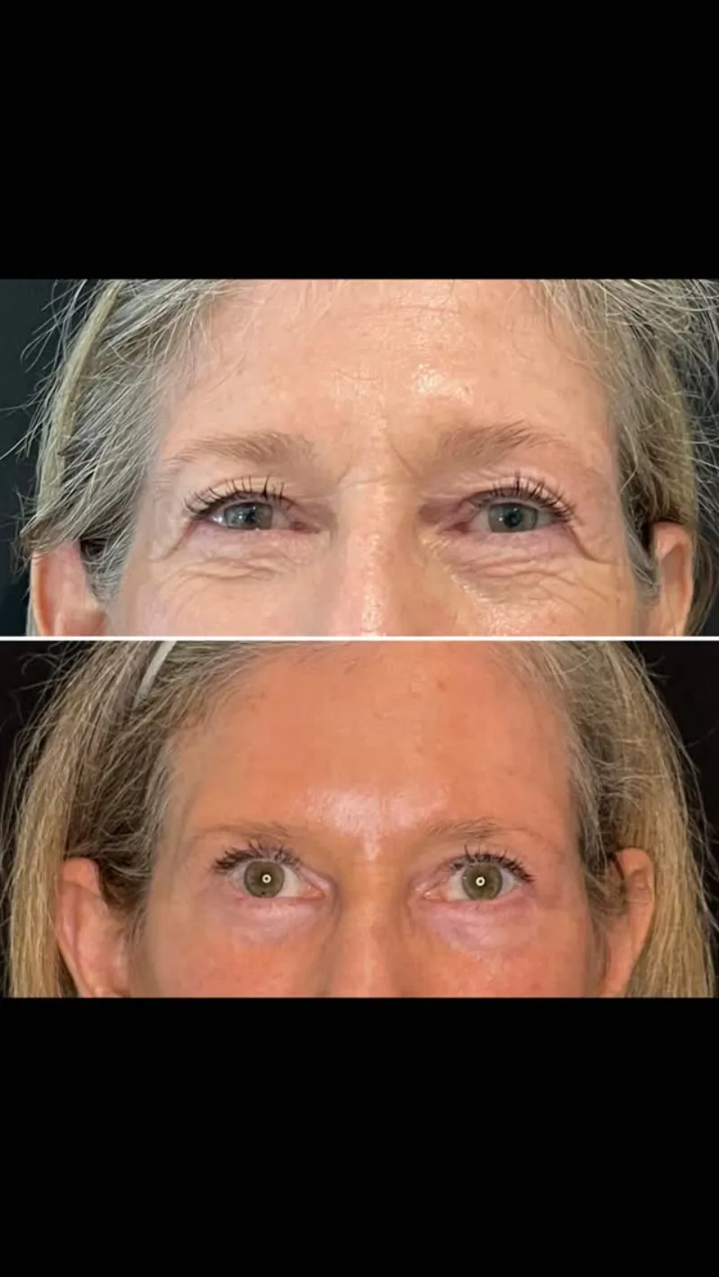Before and after: Dr. Pedro Literas