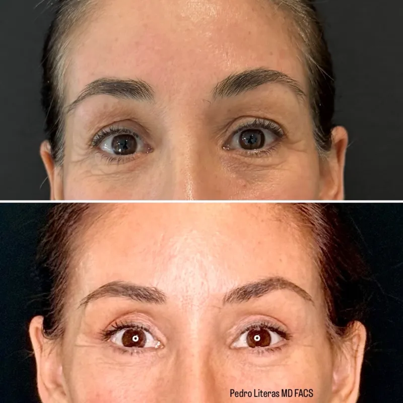Before and after: Dr. Pedro Literas