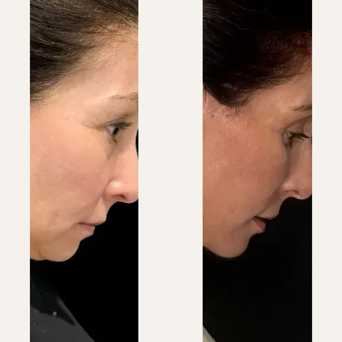 Before and after: Dr. Pedro Literas