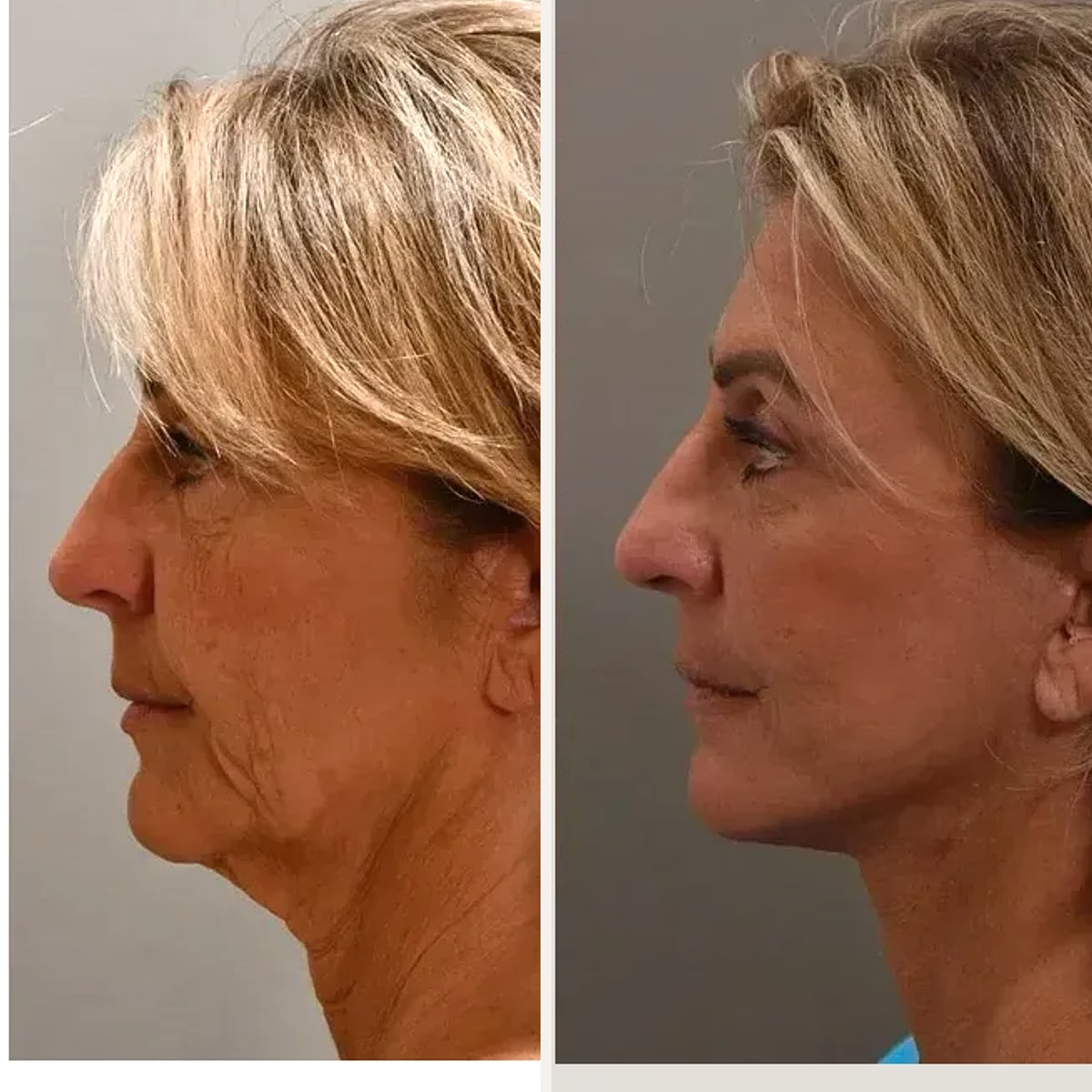Before and after: Dr. Peggy Su-Genyk