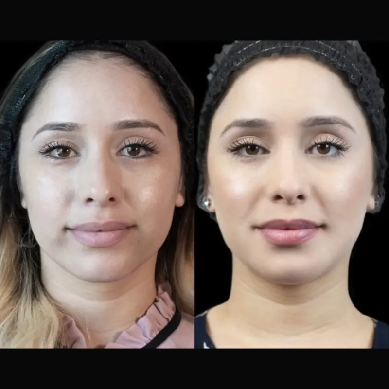 Before and after — Dr. Peter Lee