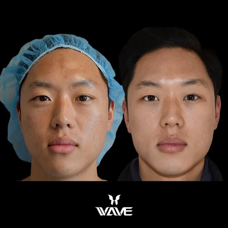 Before and after — Dr. Peter Lee