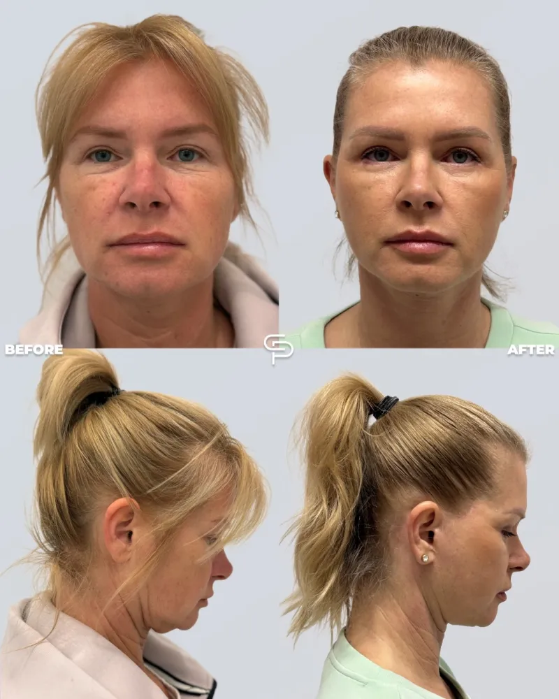 Before and after: Dr. Petros Christodoulou