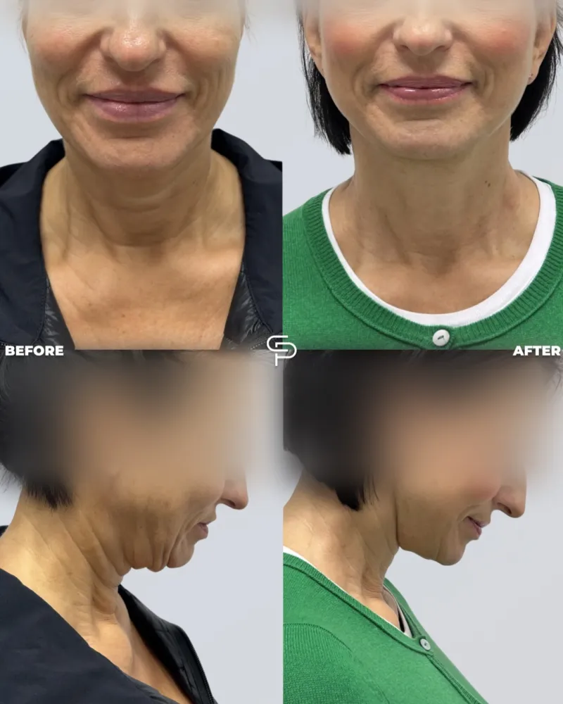 Before and after: Dr. Petros Christodoulou