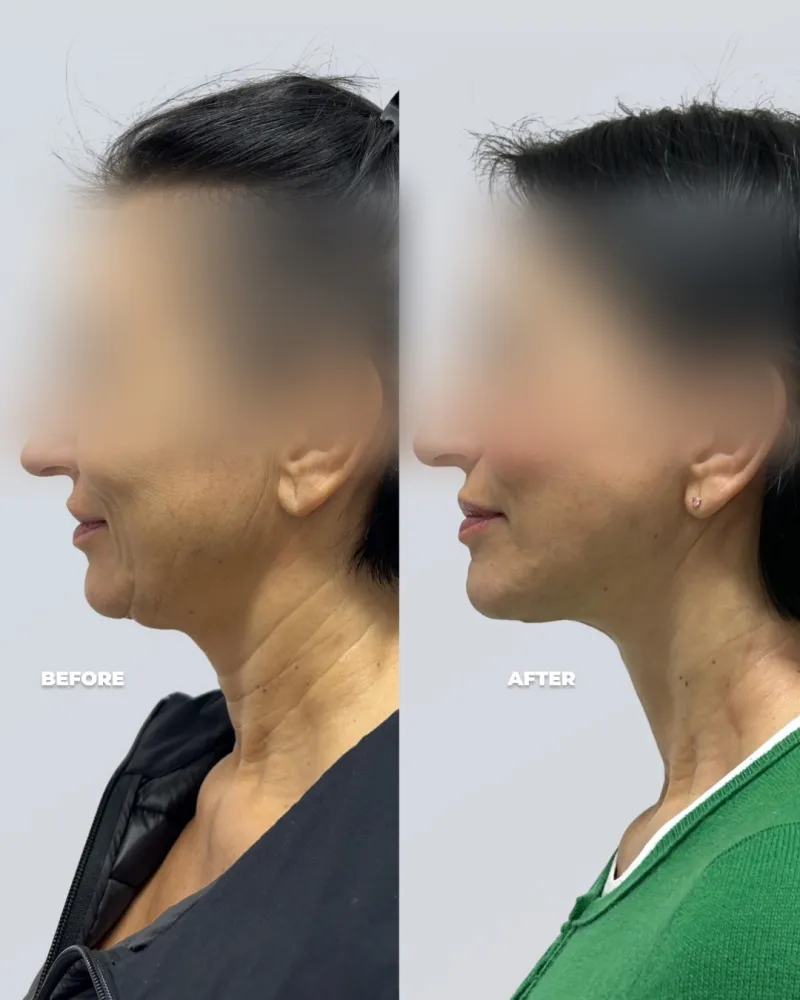 Before and after: Dr. Petros Christodoulou