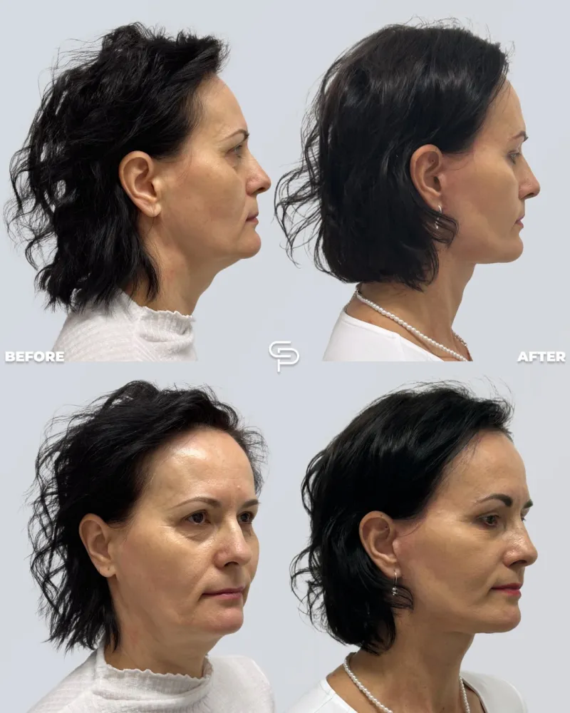 Before and after: Dr. Petros Christodoulou