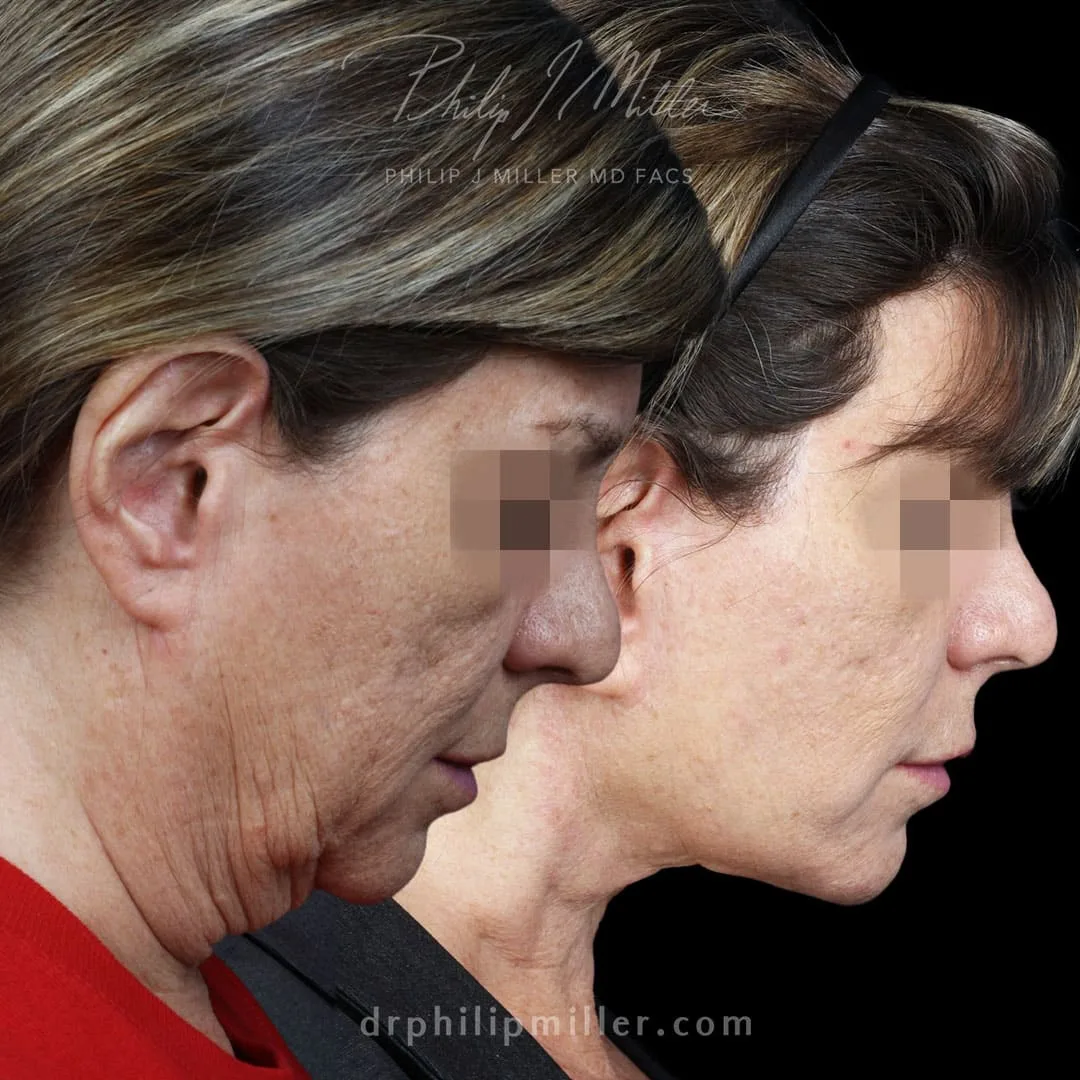 Before and after — Dr. Philip Miller
