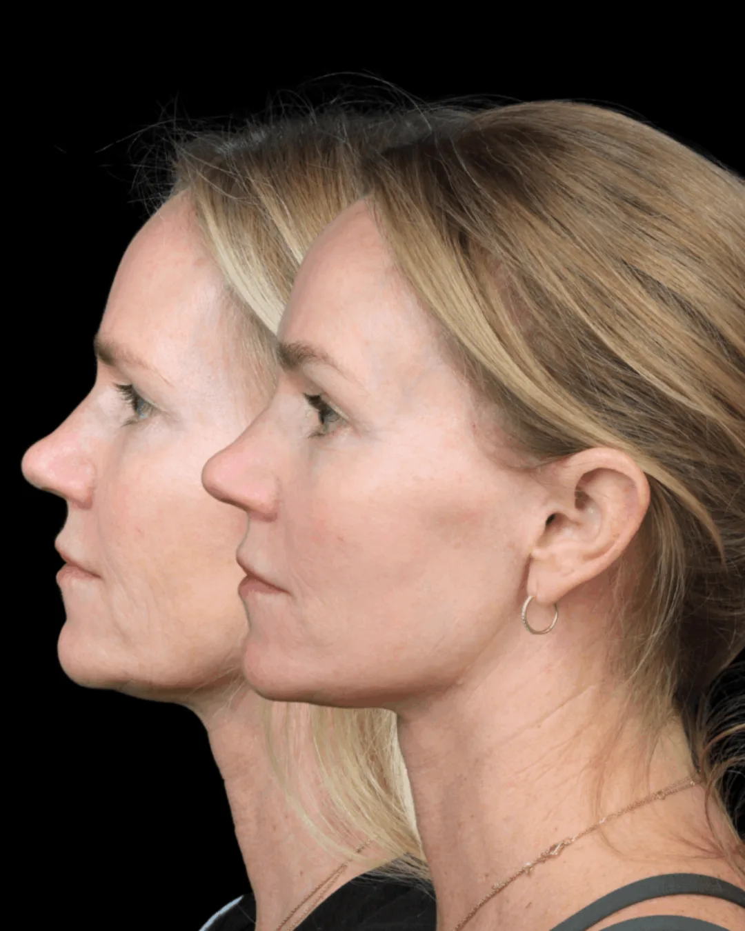 Before and after — Dr. Philip Miller