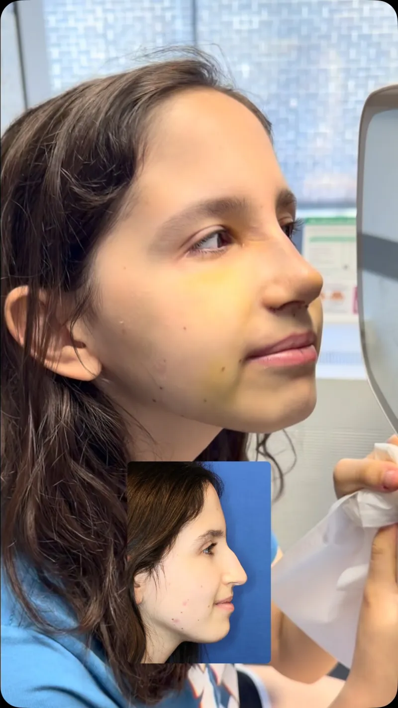 Before and after — Dr. Philip Schoenfeld