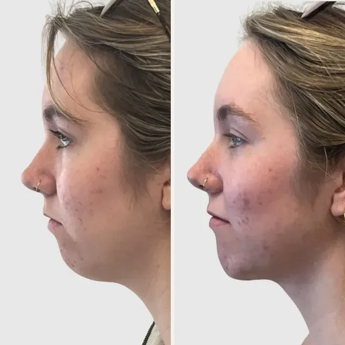Before and after: Dr. Philip Wasicek