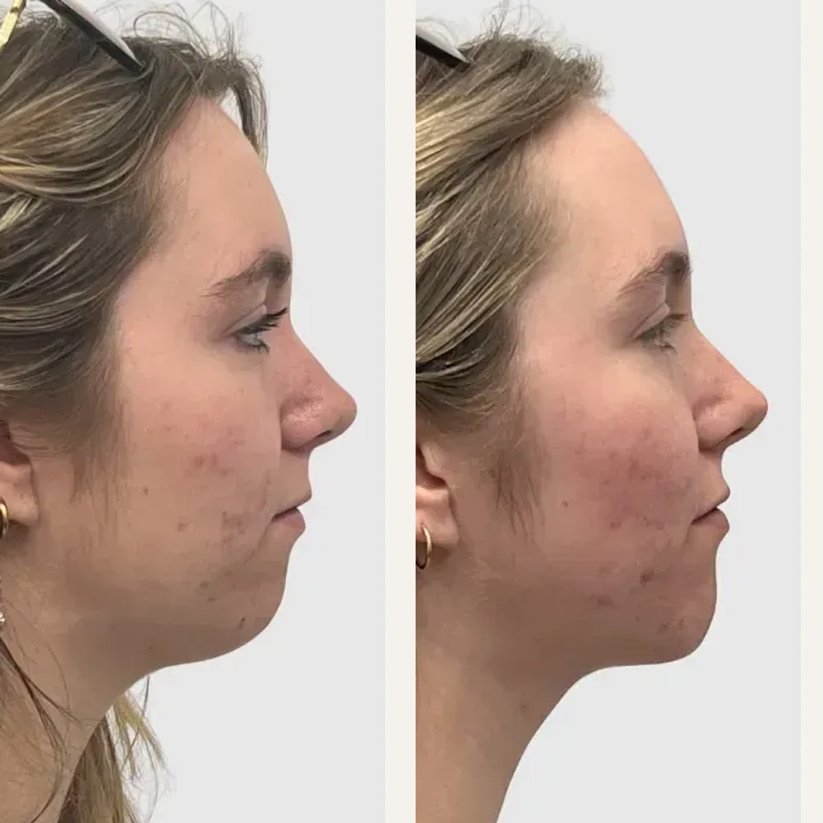 Before and after: Dr. Philip Wasicek