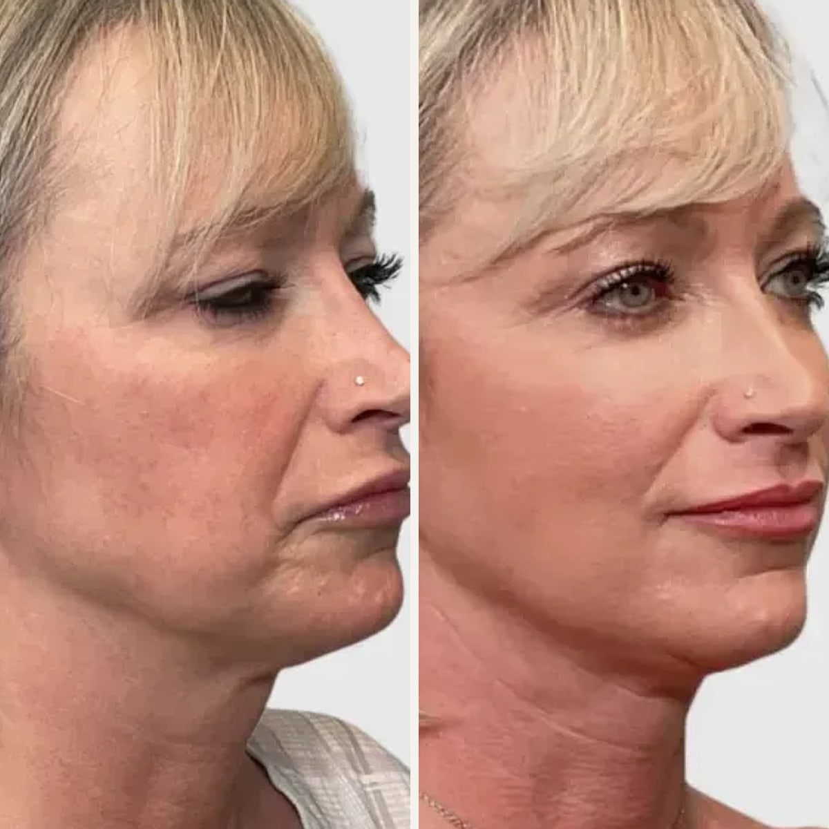 Before and after: Dr. Philip Wasicek