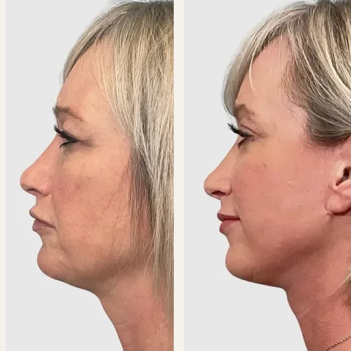 Before and after: Dr. Philip Wasicek