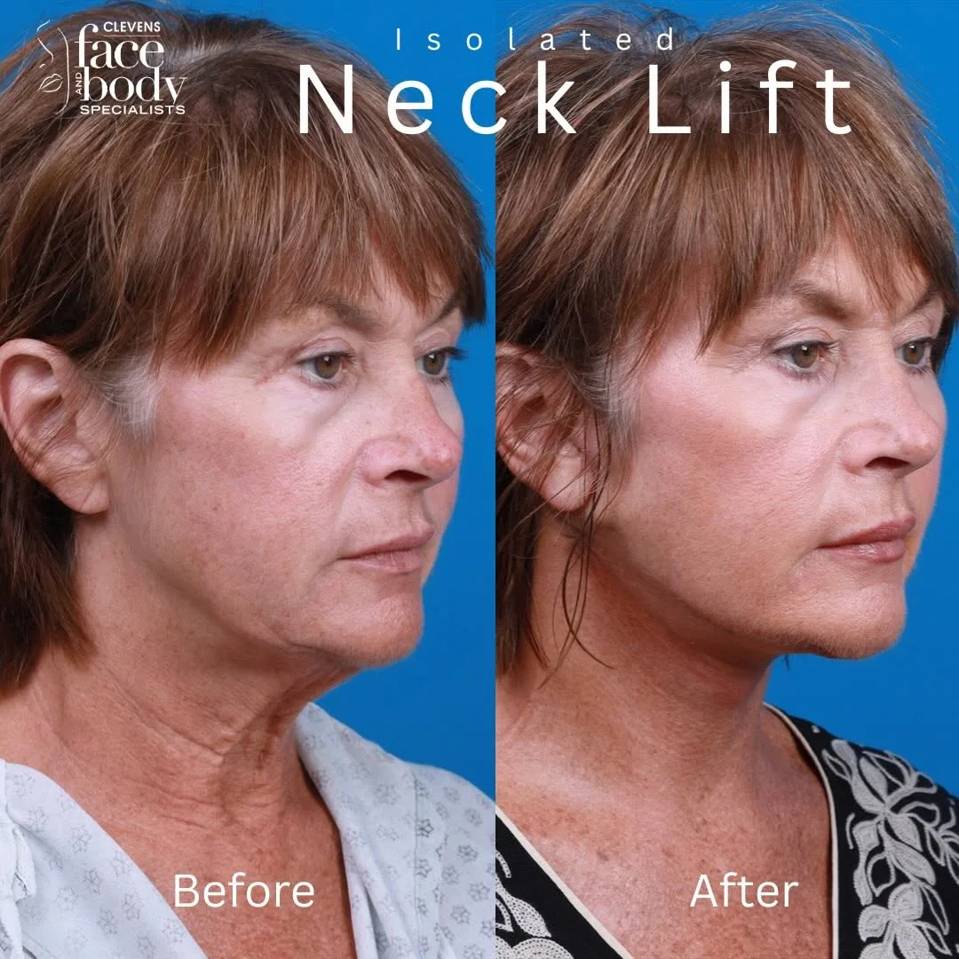 Before and after — Dr. Phillip Barbee