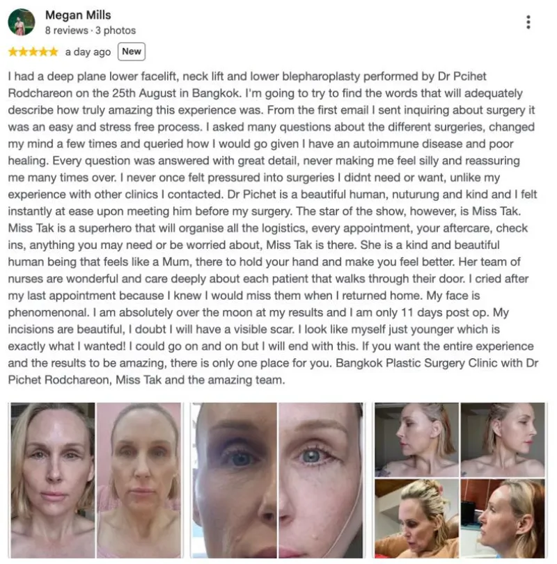 Before and after: Dr. Pichet Rodchareon