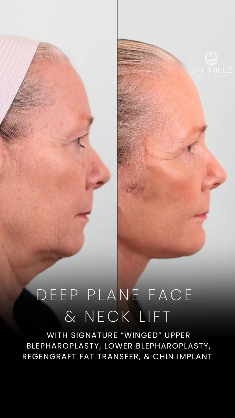 Before and after: Dr. Prem Tripathi