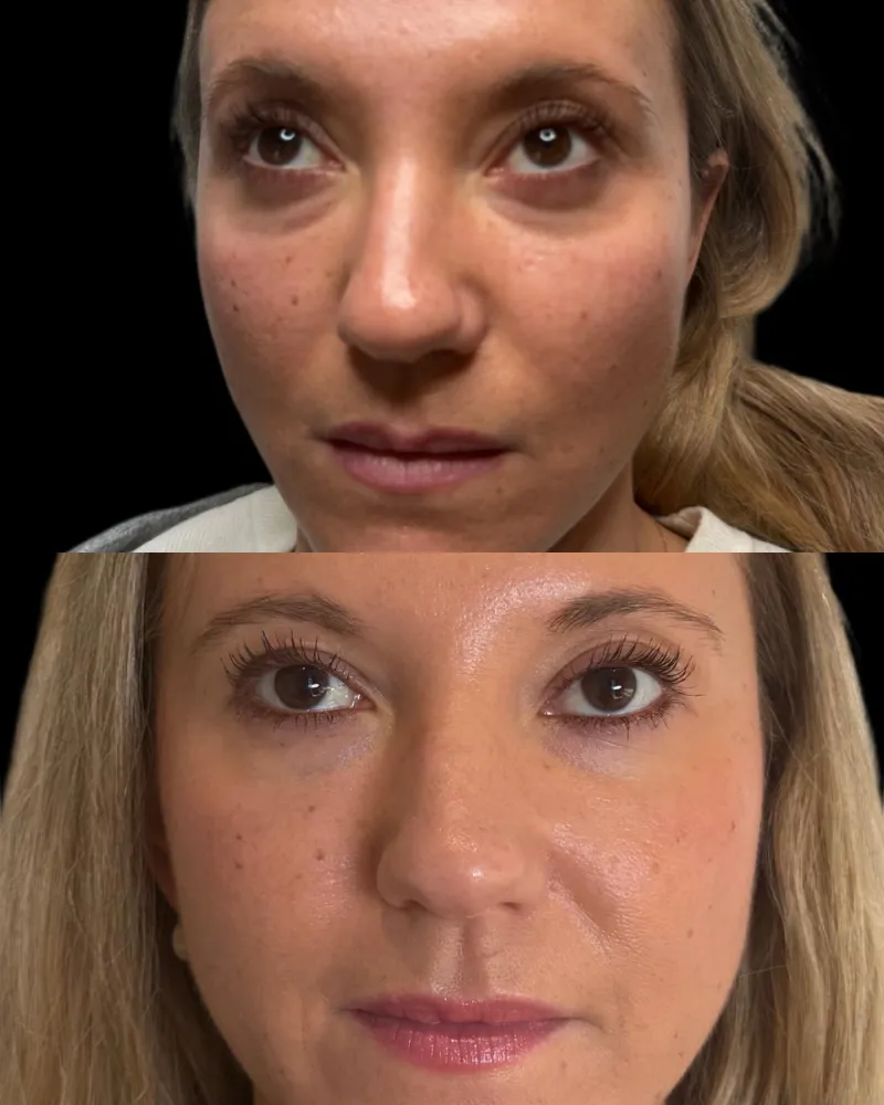 Before and after: Dr. Rafael Loucas