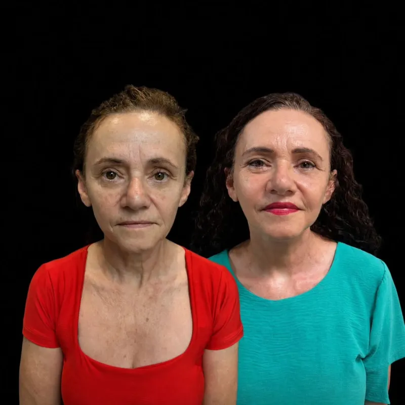 Before and after: Dr. Rafael Meirelles