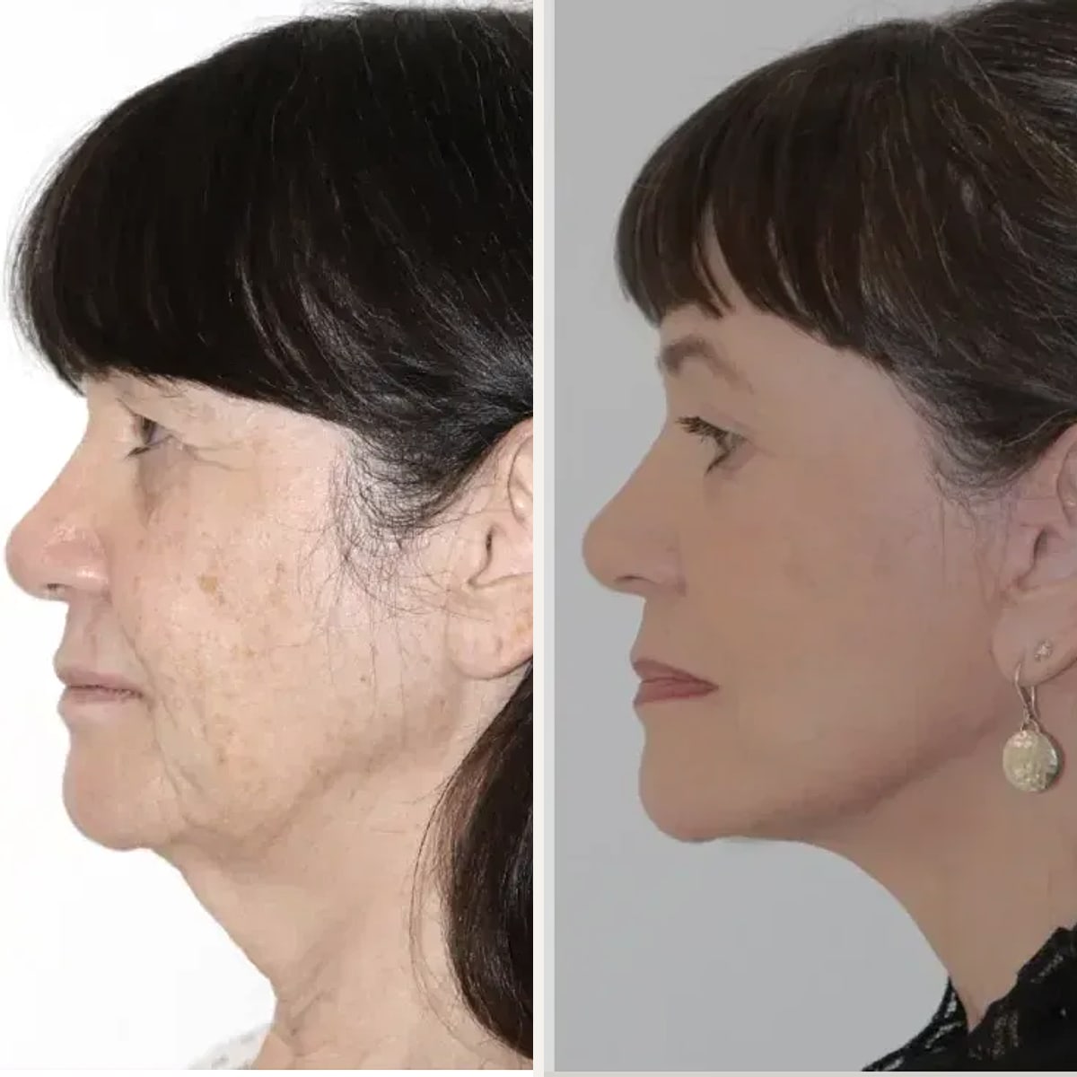 Before and after: Dr. Rajiv Grover