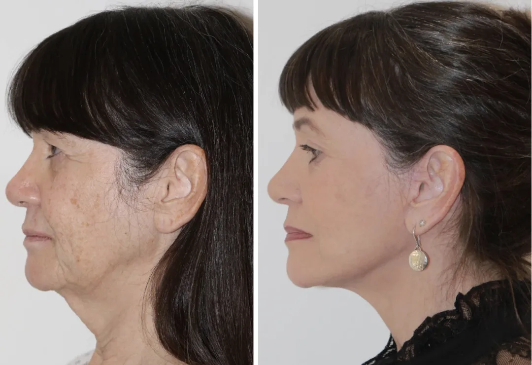 Before and after — Dr. Rajiv Grover
