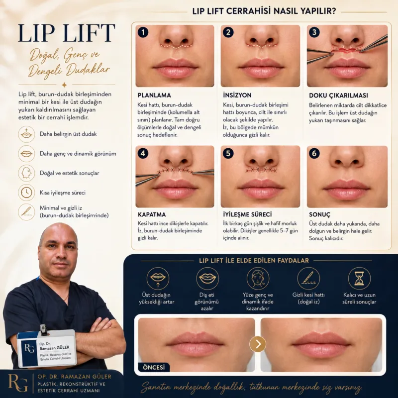 Before and after — Dr. Ramazan Güler