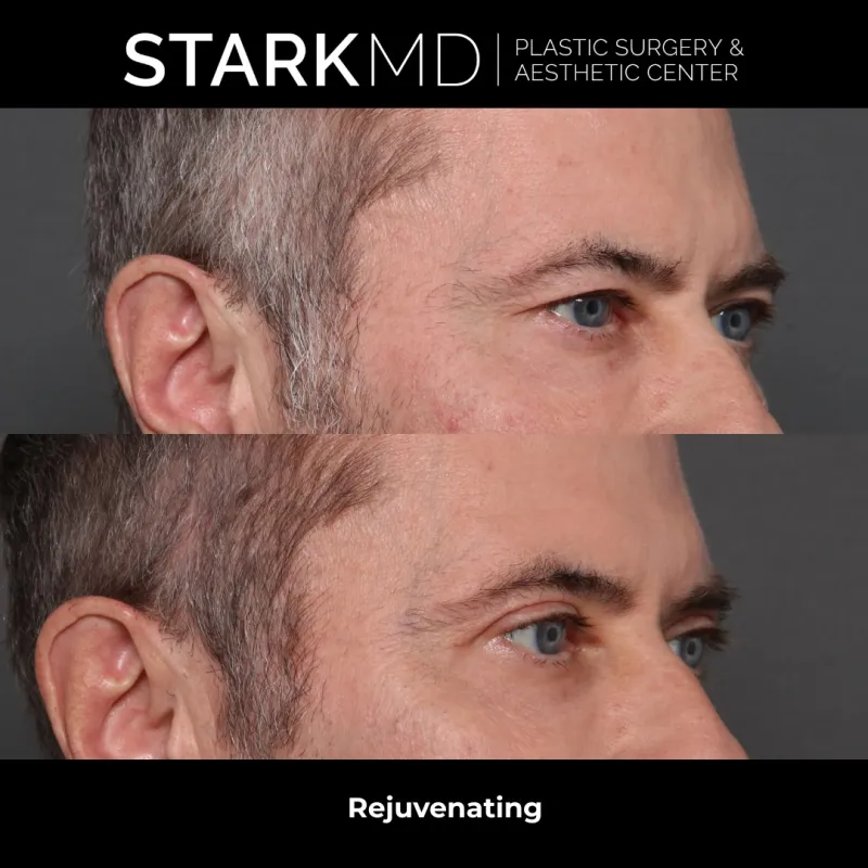 Before and after: Dr. Ran Stark