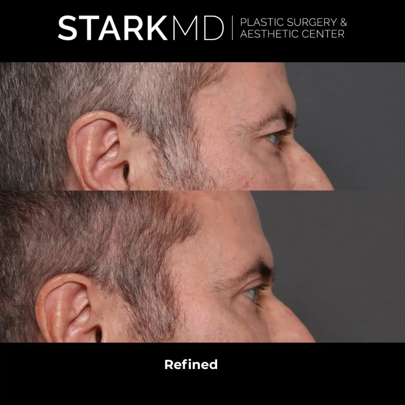Before and after: Dr. Ran Stark