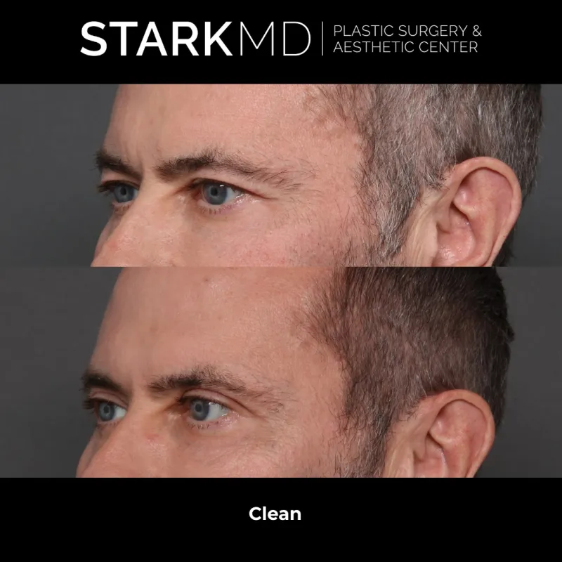 Before and after: Dr. Ran Stark