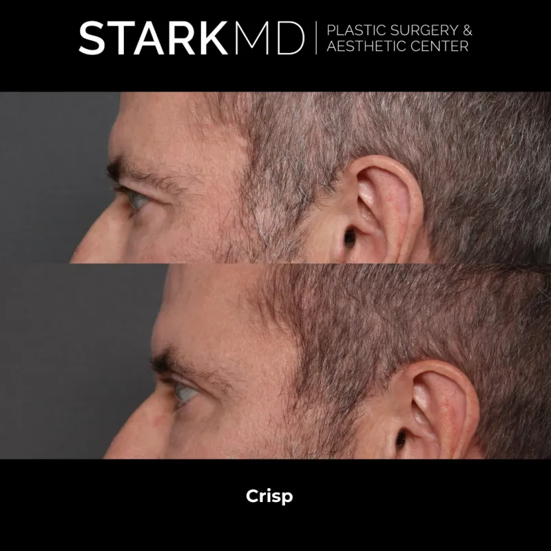 Before and after: Dr. Ran Stark