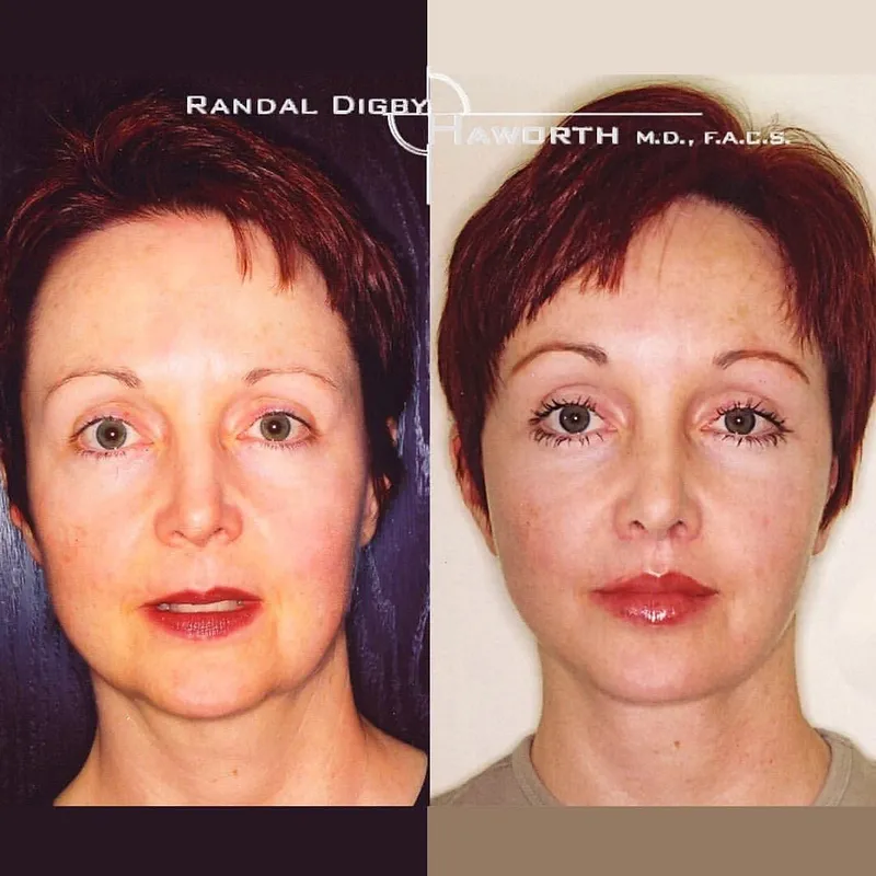 Before and after — Dr. Randal Haworth