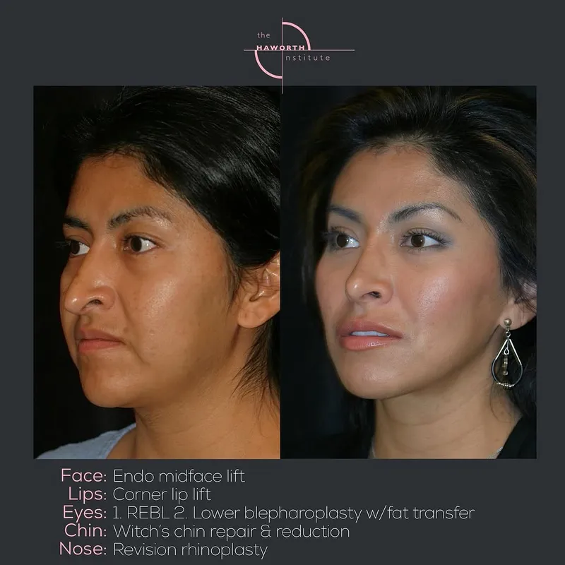 Before and after — Dr. Randal Haworth