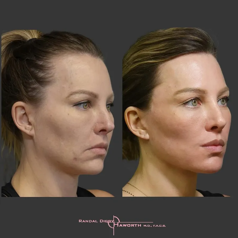 Before and after — Dr. Randal Haworth