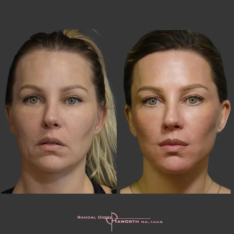 Before and after — Dr. Randal Haworth